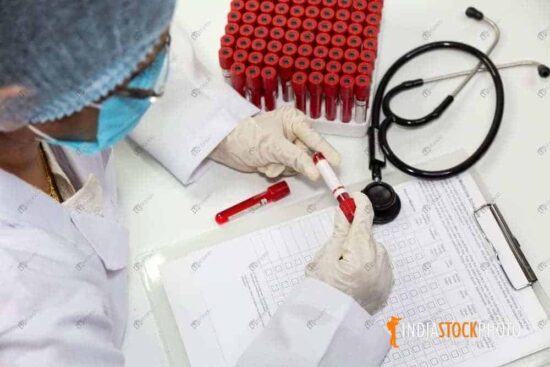 Doctor examines blood sample vials of patients
