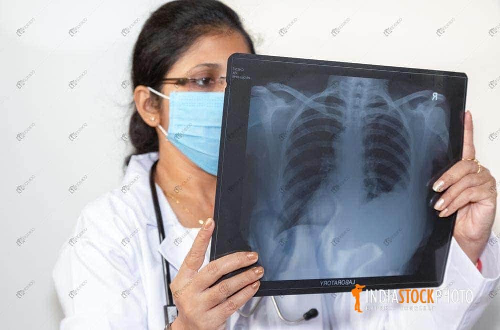 Indian doctor examine chest radiograph x ray