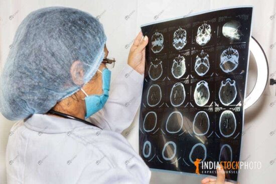Female Neurologist examine brain scan report