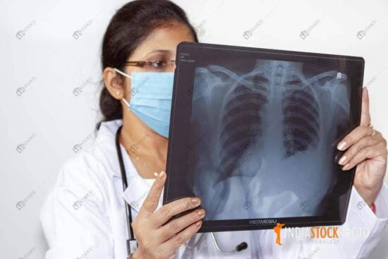Lady doctor examines a chest x-ray plate at healthcare clinic